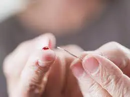 Có nên bấm kim cấp cứu bệnh nhân đột quỵ? Những sai lầm chết người cần tránh